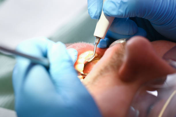 Best Emergency Denture Repair in Georgetown, PA