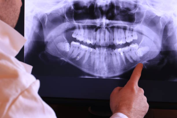 Best Emergency Tooth Extraction in Georgetown, PA
