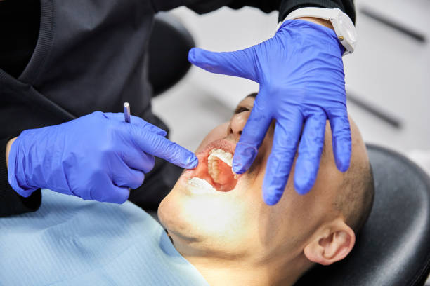 Best Urgent Care for Lost Fillings or Crowns in Georgetown, PA