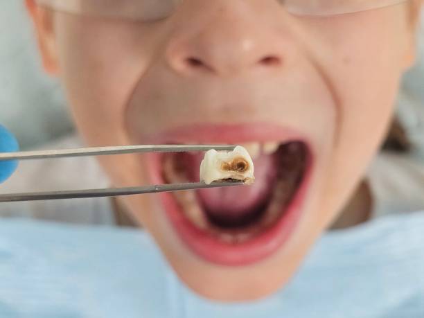 Best Same-Day Emergency Dental Services in Georgetown, PA